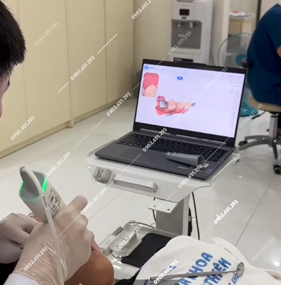 Xe đẩy máy scan nha khoa