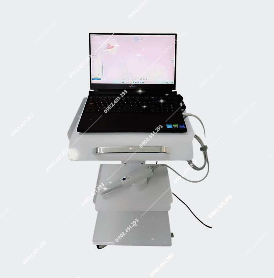Xe đẩy máy scan nha khoa